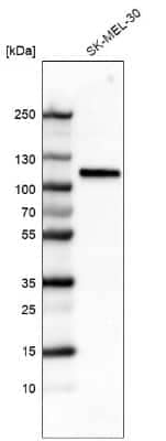 Western Blot: Sortilin Antibody (CL6526) [NBP2-76498] - Analysis in human cell line SK-MEL-30.