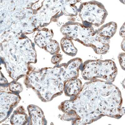 Immunohistochemistry-Paraffin: Sortilin Antibody (CL6528) [NBP2-76501] - Staining of human placenta shows moderate cytoplasmic positivity in trophoblastic cells.