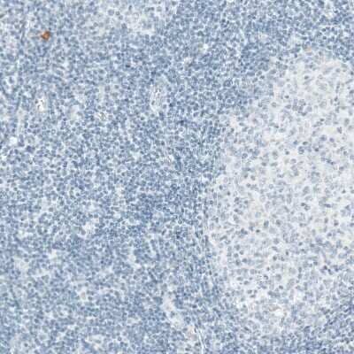 Immunohistochemistry-Paraffin: Sortilin Antibody (CL6528) [NBP2-76501] - Staining of human tonsil shows no positivity in lymphoid cells as expected.