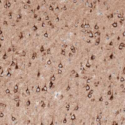 Immunohistochemistry-Paraffin: Sortilin Antibody (CL6528) [NBP2-76501] - Staining of mouse cerebral cortex shows strong cytoplasmic positivity in neurons.