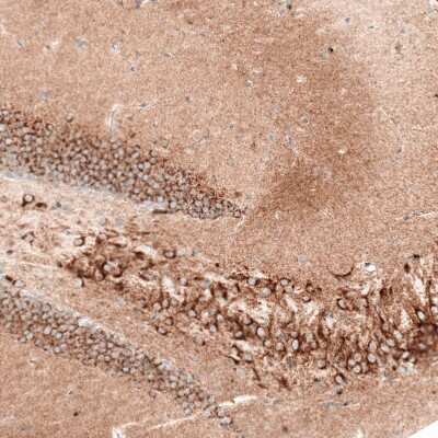 <b>Genetic Strategies Validation. </b>Immunohistochemistry-Paraffin: Sortilin Antibody (CL6528) [NBP2-76501] - Staining of mouse hippocampus shows strong cytoplasmic positivity in both pyramidal neurons and granular cells.