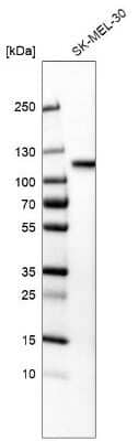 Western Blot: Sortilin Antibody (CL6528) [NBP2-76501] - Analysis in human cell line SK-MEL-30.