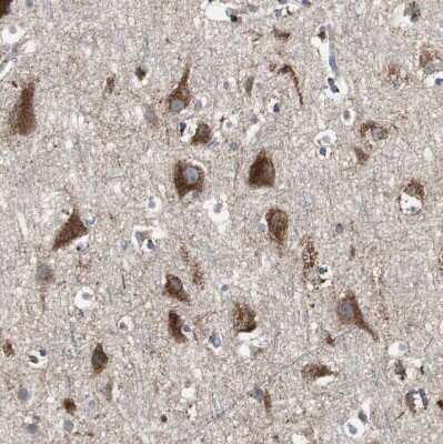 Immunohistochemistry-Paraffin: Sortilin Antibody [NBP1-89745] - Staining of human cerebral cortex shows moderate to strong cytoplasmic positivity in neurons.