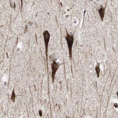 Immunohistochemistry-Paraffin: Sortilin Antibody [NBP1-89745] - Staining of human hippocampus shows strong cytoplasmic positivity in neurons.