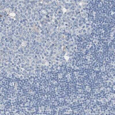 Immunohistochemistry-Paraffin: Sortilin Antibody [NBP1-89745] - Staining of human lymph node shows no positivity in non-germinal center cells as expected.