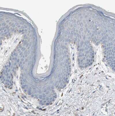 Immunohistochemistry-Paraffin: Sortilin Antibody [NBP1-89745] - Staining of human skin shows no positivity in squamous epithelial cells as expected.