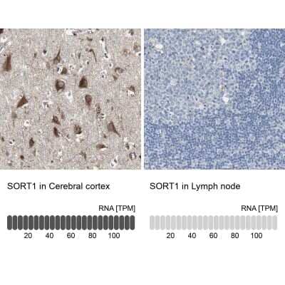 <b>Orthogonal Strategies Validation. </b>Immunohistochemistry-Paraffin: Sortilin Antibody [NBP1-89745] - Staining in human cerebral cortex and lymph node tissues using NBP1-89745 antibody. Corresponding SORT1 RNA-seq data are presented for the same tissues.