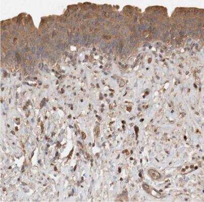 Immunohistochemistry-Paraffin: Sorting Nexin 31 Antibody [NBP1-92423] - Staining of human urinary bladder shows moderate cytoplasmic positivity in urothelial cells.