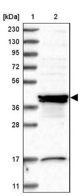 Western Blot: Sorting Nexin 31 Antibody [NBP1-92423] - Lane 1: Marker  [kDa] 230, 130, 95, 72, 56, 36, 28, 17, 11.  Lane 2: Human cell line RT-4.