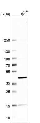 Western Blot: Sorting Nexin 31 Antibody [NBP1-92423] - Analysis in human cell line RT-4.