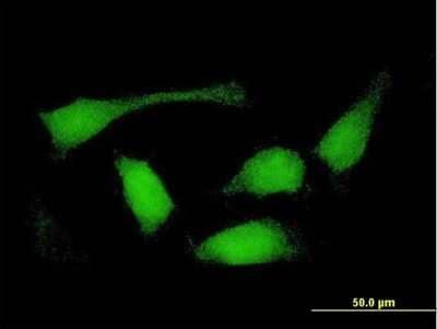 Immunocytochemistry/Immunofluorescence: Sorting Nexin 32 Antibody [H00254122-B01P] - Analysis of purified antibody to FLJ30934 on HeLa cell. (antibody concentration 10 ug/ml)