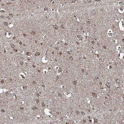 Immunohistochemistry: Sorting Nexin 32 Antibody [NBP1-92424] - Immunohistochemical staining of human cerebral cortex shows moderate cytoplasmic positivity in neuronal cells and glial cells.