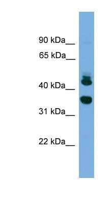 Western Blot: Sorting Nexin 32 Antibody [NBP1-79591] - NCI-H226 cell lysate, concentration 0.2-1 ug/ml.