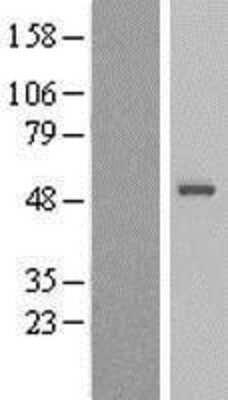 Western Blot: Sorting Nexin 32 Overexpression Lysate (Adult Normal) [NBL1-16315] Left-Empty vector transfected control cell lysate (HEK293 cell lysate); Right -Over-expression Lysate for Sorting Nexin 32.