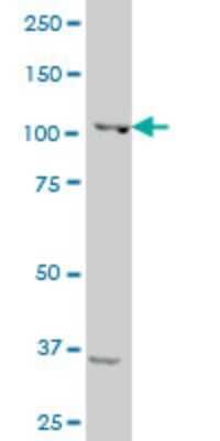 Western Blot: Sp3 Antibody (1D3) [H00006670-M13] - Analysis of SP3 expression in human Intestinal wall.