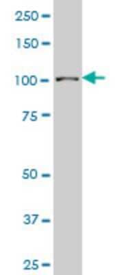 Western Blot: Sp3 Antibody (2F6) [H00006670-M08] - Analysis of SP3 expression in human stomach.