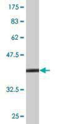 Western Blot: Spasmolytic Polypeptide Antibody (2A10) [H00007032-M01] - detection against Immunogen (39.93 KDa) .