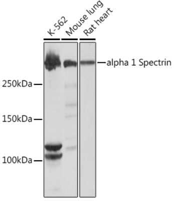 Western Blot: Spectrin alpha 1 Antibody (1U5K4) [NBP3-16833] - Western blot analysis of extracts of various cell lines, using Spectrin alpha 1 Rabbit mAb (NBP3-16833) at 1:1000 dilution. Secondary antibody: HRP Goat Anti-Rabbit IgG (H+L) at 1:10000 dilution. Lysates/proteins: 25ug per lane. Blocking buffer: 3% nonfat dry milk in TBST. Detection: ECL Basic Kit. Exposure time: 10s.