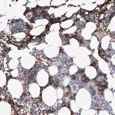 Immunohistochemistry-Paraffin: Spectrin alpha 1 Antibody [NBP1-87953] - Staining of human bone marrow shows moderate membranous positivity in hematopoietic cells.