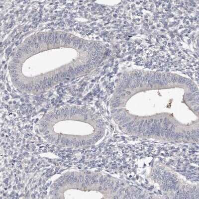 Immunohistochemistry-Paraffin: Spectrin alpha 1 Antibody [NBP1-87953] - Staining of human endometrium shows no positivity in glandular cells as expected.