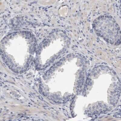 Immunohistochemistry-Paraffin: Spectrin alpha 1 Antibody [NBP1-87953] - Staining of human prostate shows no positivity in glandular cells as expected.