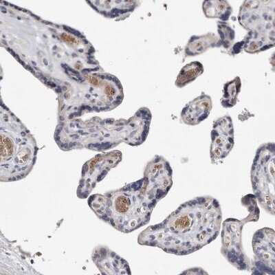 Immunohistochemistry-Paraffin: Spectrin alpha 1 Antibody [NBP1-87953] - Staining of human placenta shows moderate membranous positivity in erythrocytes.