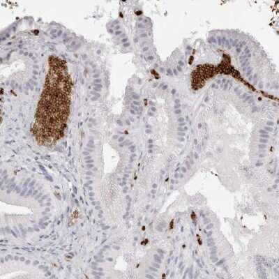 Immunohistochemistry-Paraffin: Spectrin alpha 1 Antibody [NBP2-33911] - Staining of human gall bladder shows strong cytoplasmic positivity in red blood cells.