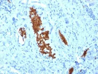 Immunohistochemistry-Paraffin: Spectrin alpha 1 Antibody (SPTA1/1810) - Azide and BSA Free [NBP2-79860] - Formalin-fixed, paraffin-embedded human Tonsil stained with Spectrin alpha 1 Antibody (SPTA1/1810).