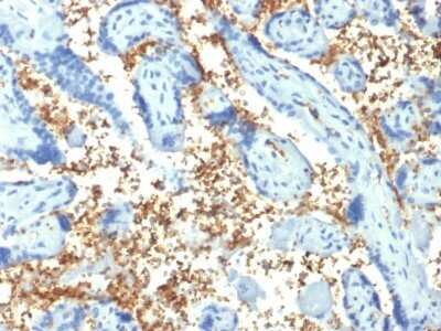 Immunohistochemistry-Paraffin: Spectrin alpha 1 Antibody (SPTA1/1810) - Azide and BSA Free [NBP2-79860] - Formalin-fixed, paraffin-embedded human Placenta stained with Spectrin alpha 1 Antibody (SPTA1/1810).