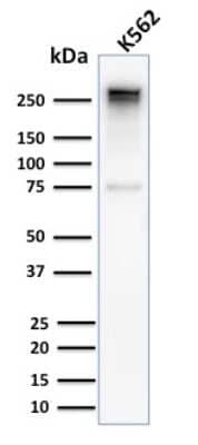 Western Blot: Spectrin alpha 1 Antibody (SPTA1/2939R) - Azide and BSA Free [NBP3-08346] - Western Blot Analysis of Human K562 cell lysate using Spectrin alpha 1 Rabbit Recombinant Monoclonal Antibody (SPTA1/2939R).