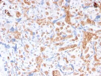 Immunohistochemistry-Paraffin: Spectrin alpha 1 Antibody (rSPTA1/1832) - Azide and BSA Free [NBP3-08317] - Formalin-fixed, paraffin-embedded human Placenta stained with Spectrin alpha 1 Mouse Recombinant Monoclonal Antibody (rSPTA1/1832).