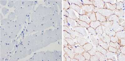 Immunohistochemistry-Paraffin: Spectrin beta 1 Antibody (4C3) [NB300-574] - Analysis showing positive staining in the membrane of Human skeletal muscle (right) compared with a negative control in the absence of primary antibody (left).