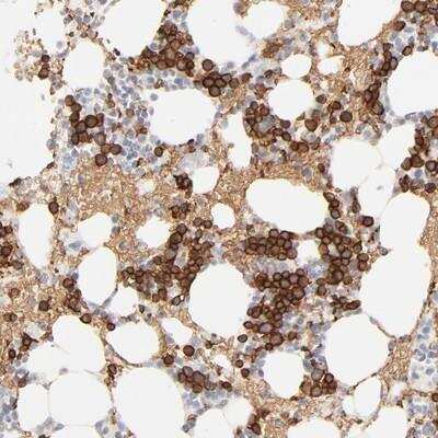 Immunohistochemistry: Spectrin beta 1 Antibody [NBP1-87596] - Staining of human bone marrow shows strong cytoplasmic positivity in bone marrow poietic cells.