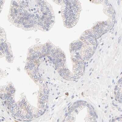 Immunohistochemistry-Paraffin: Spectrin beta 1 Antibody [NBP1-87596] - Staining of human prostate shows low expression as expected.