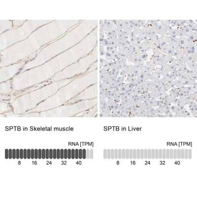 Immunohistochemistry-Paraffin: Spectrin beta 1 Antibody [NBP1-87596] - Analysis in human skeletal muscle and liver tissues using NBP1-87596 antibody. Corresponding Spectrin beta 1 RNA-seq data are presented for the same tissues.