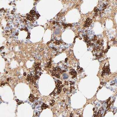 Immunohistochemistry-Paraffin: Spectrin beta 1 Antibody [NBP1-90350] - Staining of human bone marrow shows strong cytoplasmic positivity in bone marrow poietic cells.