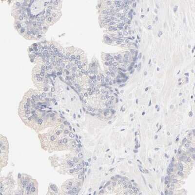 Immunohistochemistry-Paraffin: Spectrin beta 1 Antibody [NBP1-90350] - Staining of human prostate shows low expression as expected.