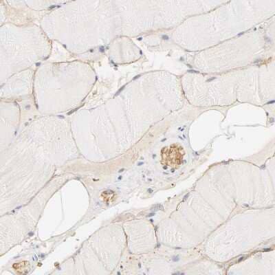 Immunohistochemistry-Paraffin: Spectrin beta 1 Antibody [NBP1-90350] - Staining of human skeletal muscle shows high expression.