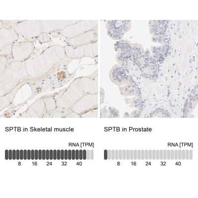 <b>Orthogonal Strategies Validation. </b>Immunohistochemistry-Paraffin: Spectrin beta 1 Antibody [NBP1-90350] - Staining in human skeletal muscle and prostate tissues using anti-SPTB antibody. Corresponding SPTB RNA-seq data are presented for the same tissues.