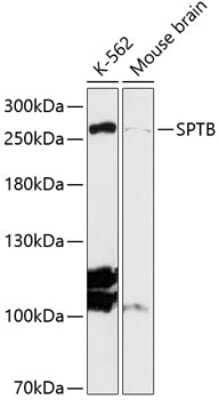 Western Blot: Spectrin beta 1 Antibody [NBP2-94242] - Analysis of extracts of various cell lines, using Spectrin beta 1 . Exposure time: 90s.