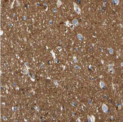 Immunohistochemistry-Paraffin Spectrin beta 2 Antibody