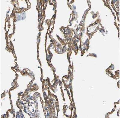 Immunohistochemistry-Paraffin Spectrin beta 2 Antibody