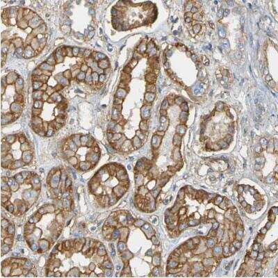 Immunohistochemistry-Paraffin Spectrin beta 2 Antibody