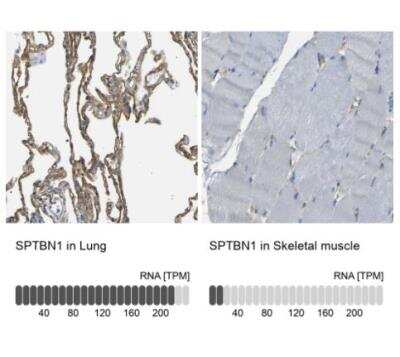 Immunohistochemistry-Paraffin: Spectrin beta 2 Antibody [NBP1-86088] - Analysis in human lung and skeletal muscle tissues using NBP1-86088 antibody. Corresponding SPTBN1 RNA-seq data are presented for the same tissues.