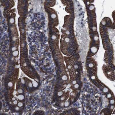 Immunohistochemistry-Paraffin: Spectrin beta 2 Antibody [NBP1-86468] - Staining of human duodenum shows strong cytoplasmic and membranous positivity in glandular cells.