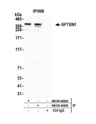 <b>Independent Antibodies Validation. </b>Immunoprecipitation: Spectrin beta 2 Antibody [NB100-40828] - Detection of human Spectrin beta 2 (SPTBN1) by western blot of immunoprecipitates. Samples: Whole cell lysate (1.0 mg per IP reaction; 20% of IP loaded) from HeLa cells prepared using NETN lysis buffer. Antibodies: Affinity purified rabbit anti-Spectrin beta 2 antibody NB100-40828 used for IP at 3 ug per reaction. SPTBN1 was also immunoprecipitated by rabbit anti-Spectrin beta 2 antibody NB100-40829. For blotting immunoprecipitated SPTBN1, NB100-40828 was used at 1 ug/ml. Detection: Chemiluminescence with an exposure time of 10 seconds.