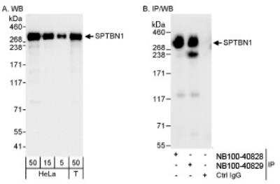 Western Blot: Spectrin beta 2 Antibody [NB100-40829] - Detection of Human SPTBN1 on HeLa whole cell lysate using NB100-40829. SPTBN1 was also immunoprecipitated by rabbit anti-SPTBN1 antibody NB100-40828.