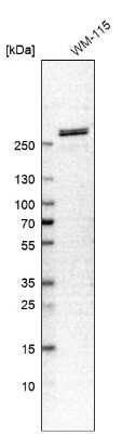 Western Blot: Spectrin beta 2 Antibody [NBP1-86088] - Analysis in human cell line WM-115.