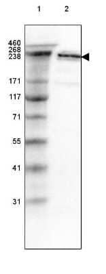 Western Blot: Spectrin beta 2 Antibody [NBP1-86468] - Lane 1: Marker [kDa] 460, 268, 238, 171, 117, 71, 55, 41, 31Lane 2: Human cell line A-549