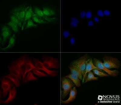 Immunocytochemistry/Immunofluorescence: Spectrin beta 3 Antibody (1287A) - Azide and BSA Free [NBP2-80958] - HeLa cells were fixed for 10 minutes using 10% formalin and then permeabilized for 5 minutes using 1X TBS + 0.5% Triton-X100. The cells were incubated with anti-Spectrin beta 3 (1287A) at 5.0ug/ml overnight at 4C and detected with an anti-rabbit Dylight 488 (Green) at a 1:500 dilution. Alpha tubulin (DM1A) NB100-690 was used as a co-stain at a 1:1000 dilution and detected with an anti-mouse Dylight 550 (Red) at a 1:500 dilution. Nuclei were counterstained with DAPI (Blue). Cells were imaged using a 40X objective. Image from the standard format of this antibody.